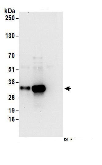 Thymidylate Synthase Antibody