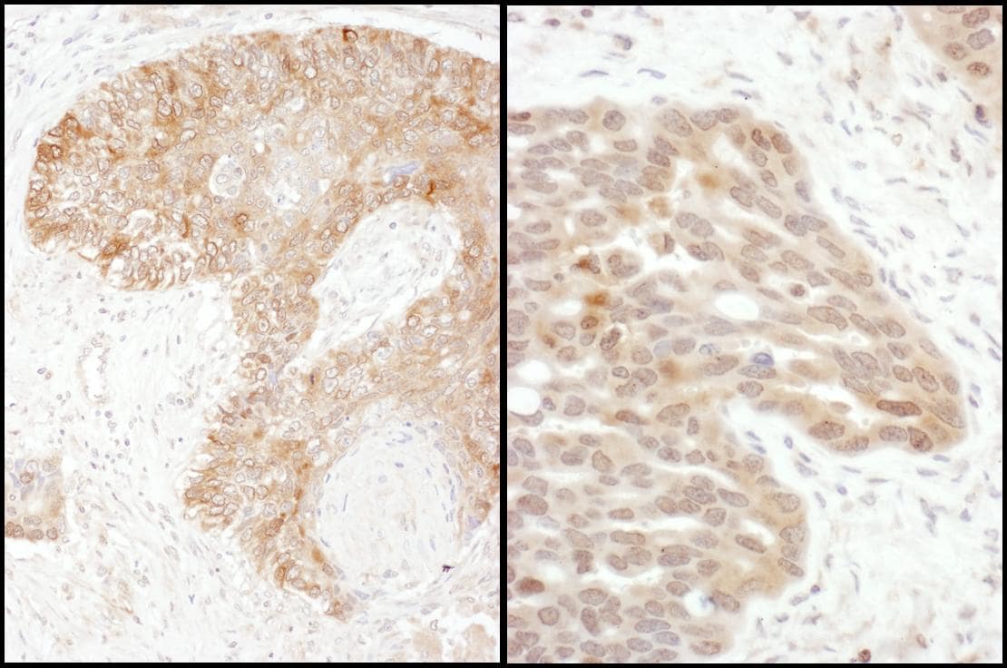 Thymidylate Synthase Antibody