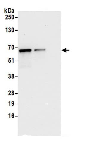 IFIT3 Antibody