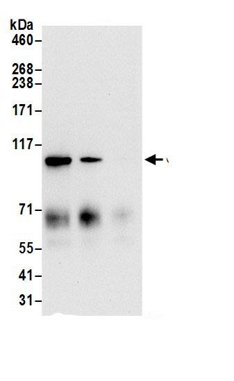 alpha Glucosidase 2 Antibody