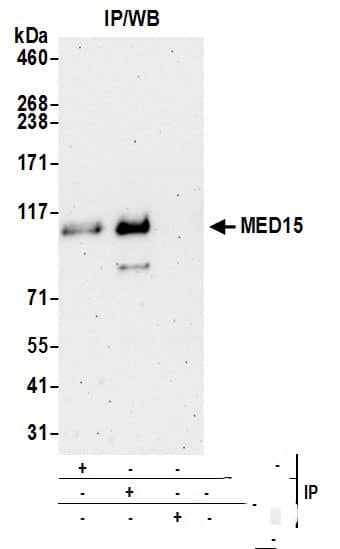 MED15 Antibody