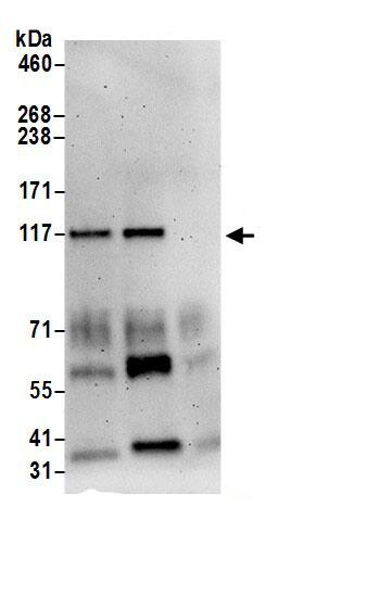 Phosphorylase B Antibody