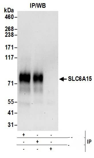 SLC6A15 Antibody