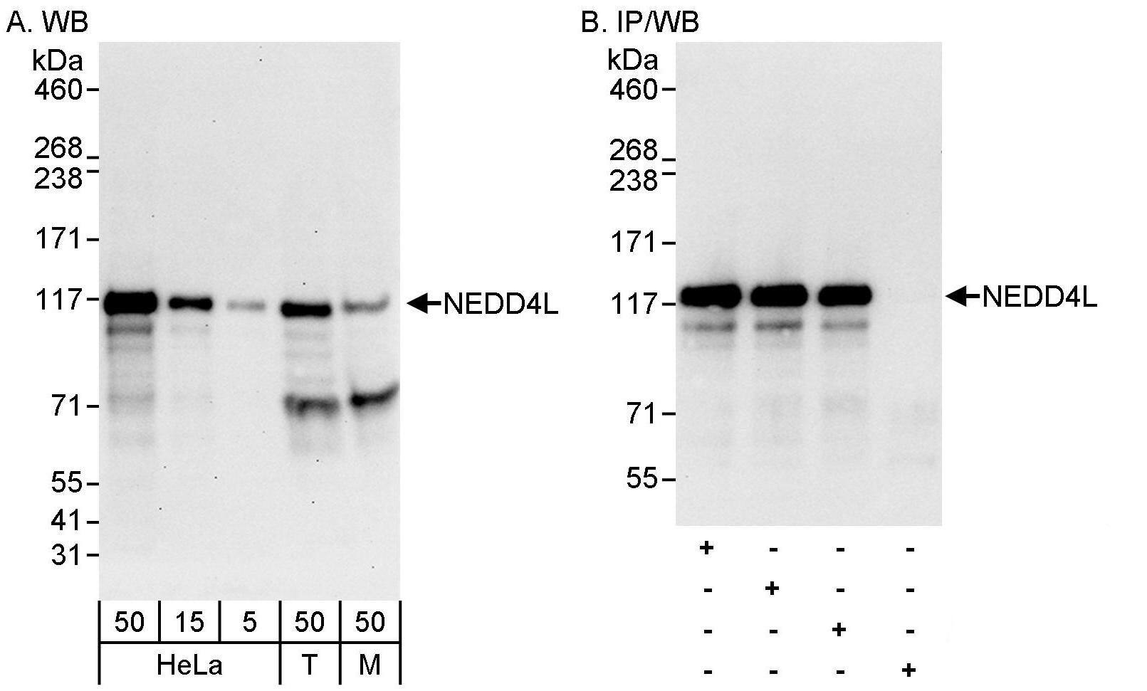 NEDD4L Antibody