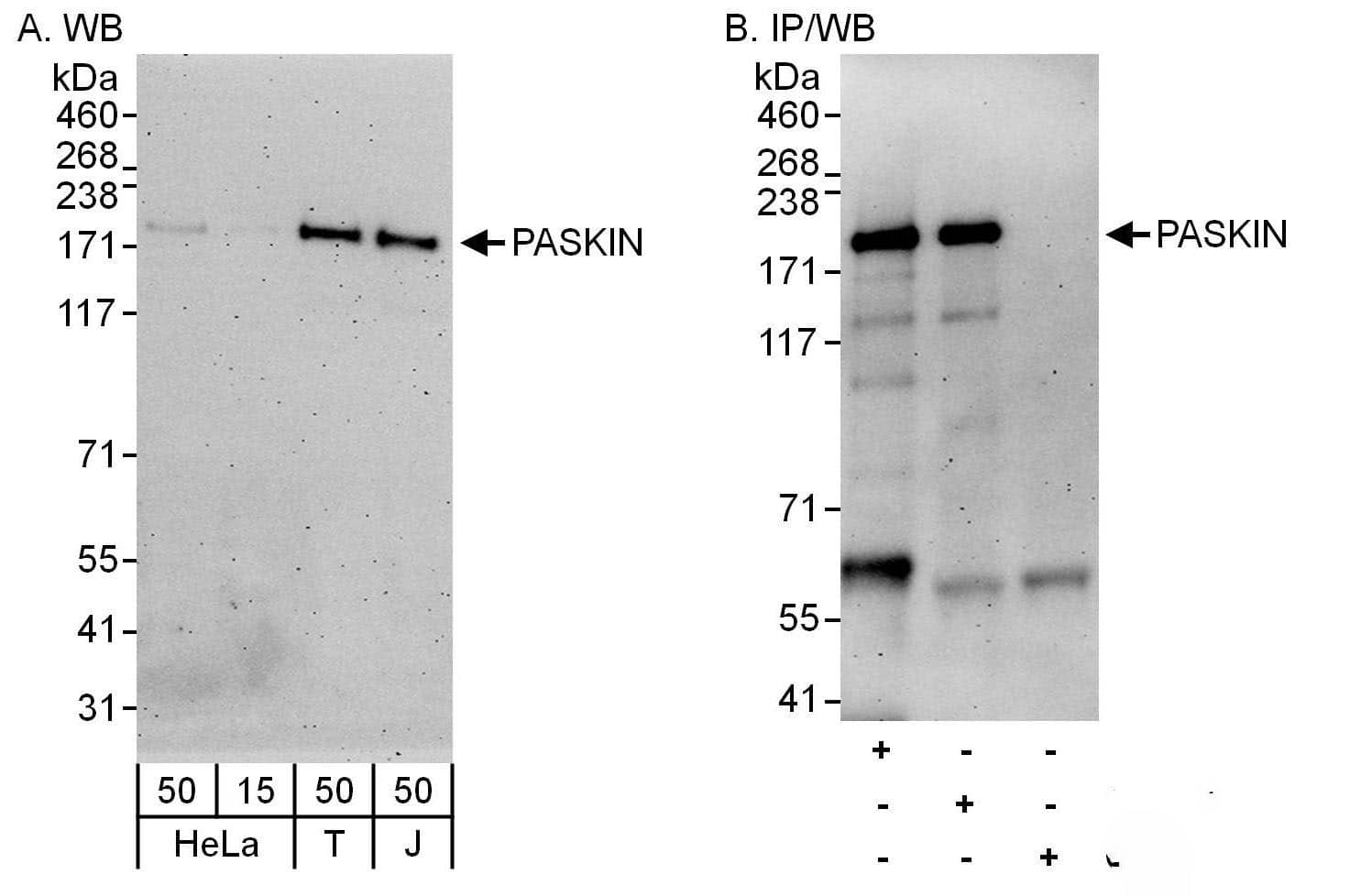 PASK Antibody