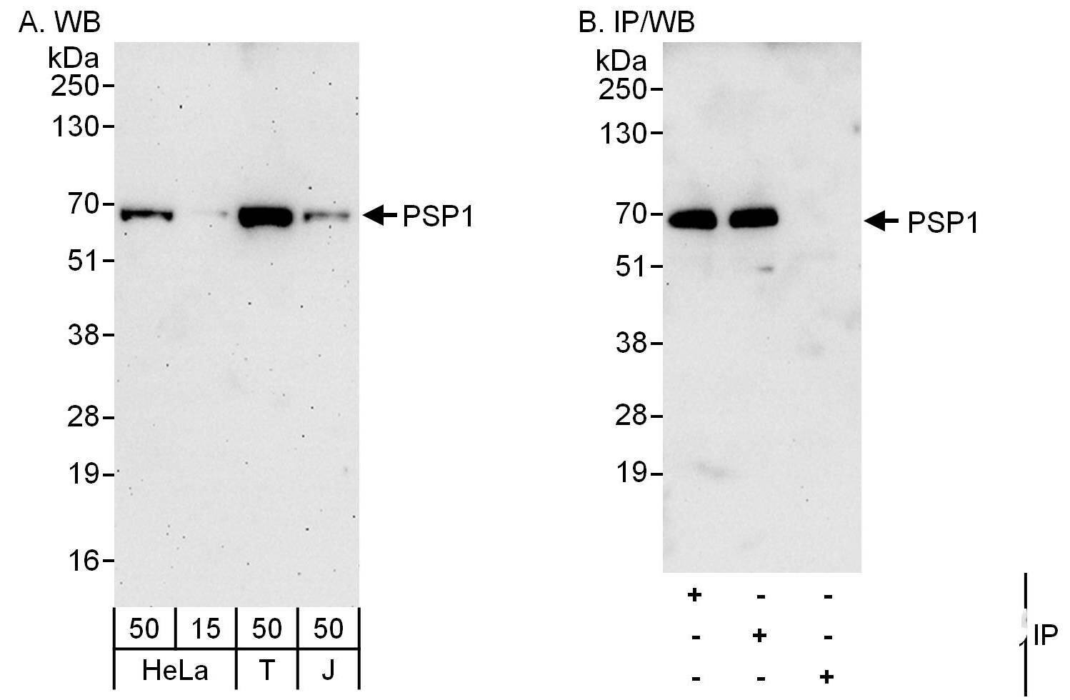 PSPC1 Antibody