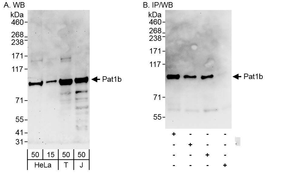 PATL1 Antibody