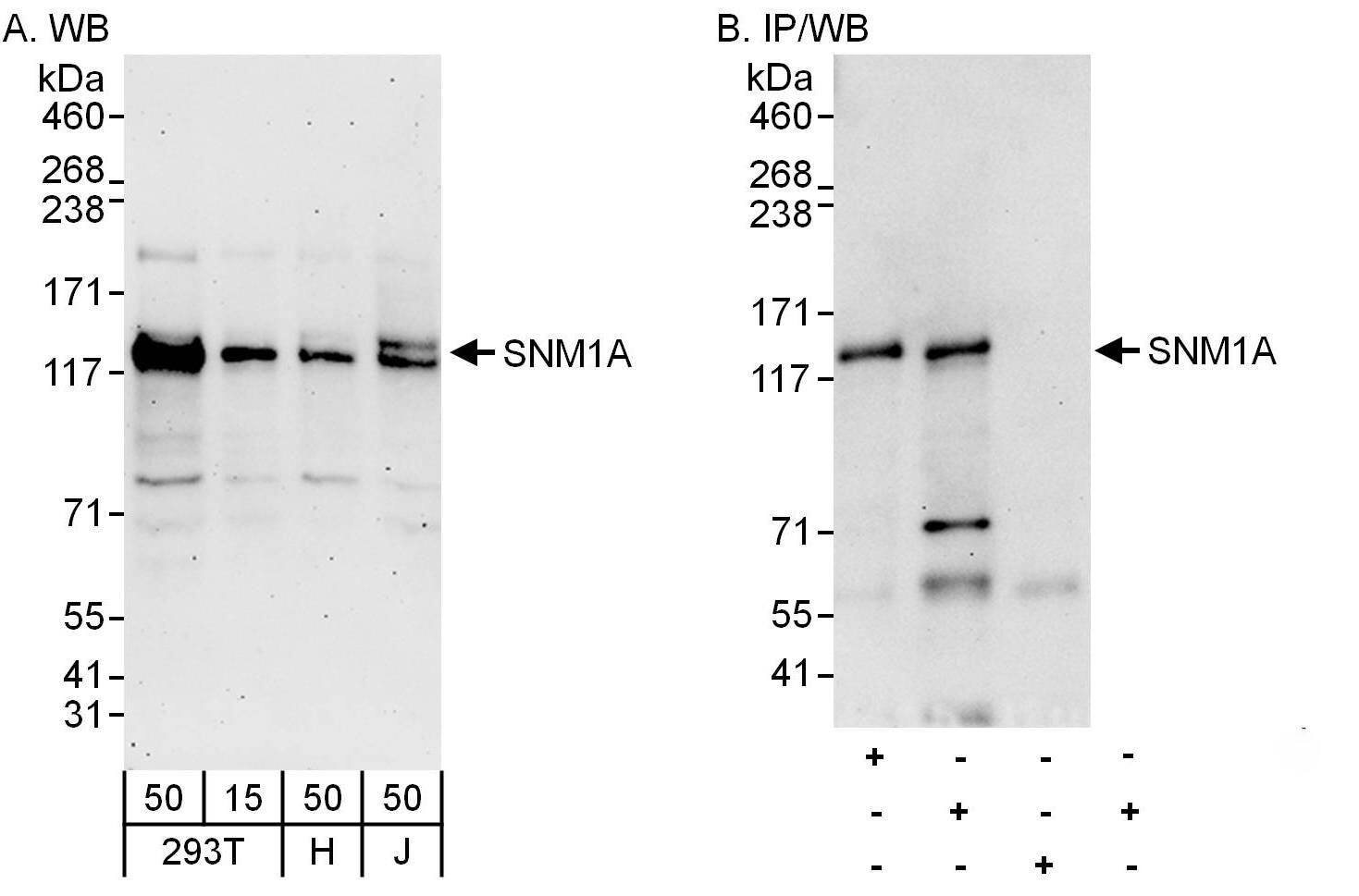 SNM1 Antibody