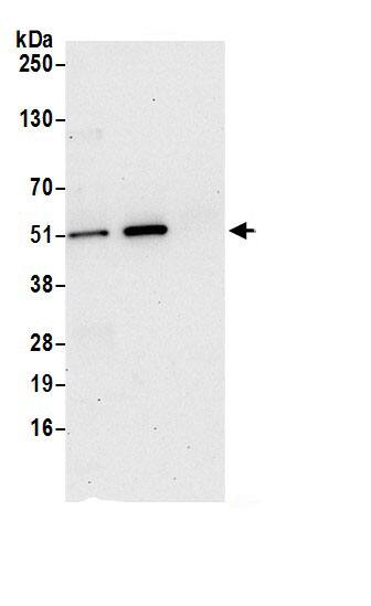 PGD Antibody