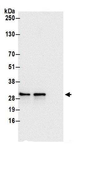 SRPRB Antibody