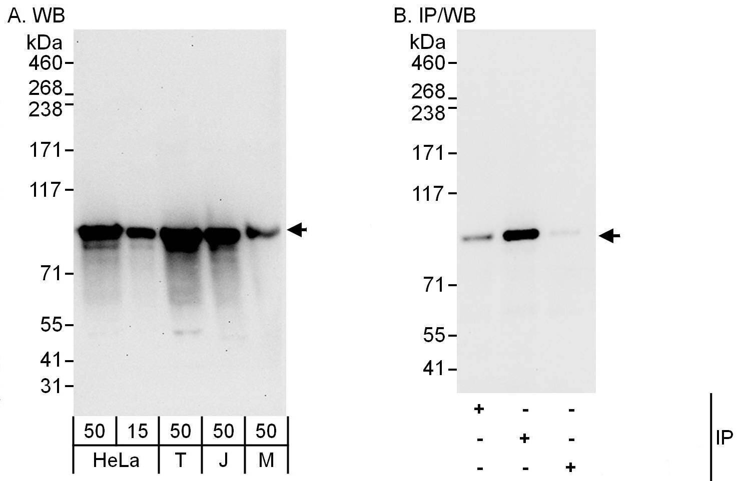 ASUN Antibody