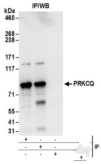 PKC theta Antibody