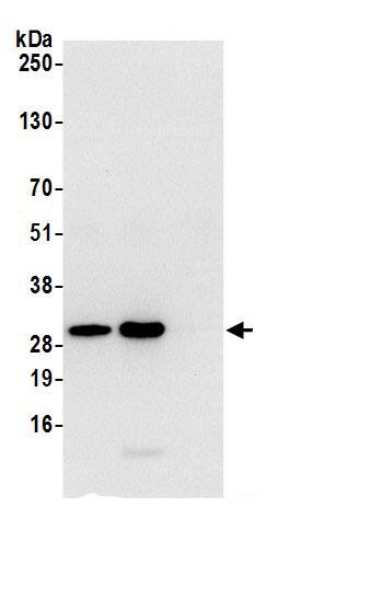 ETFB Antibody