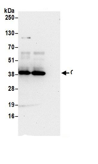 CDV3 Antibody