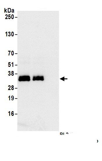 LAT Antibody