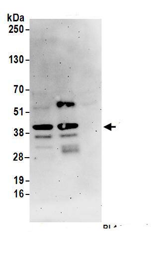 SLBP Antibody