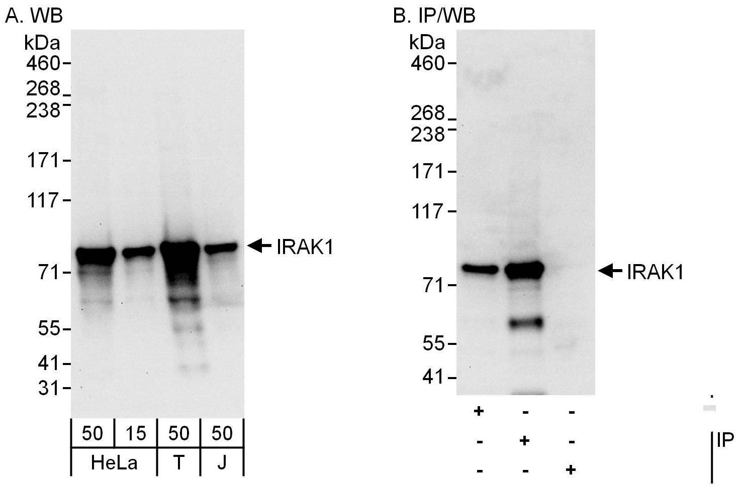 IRAK1 Antibody