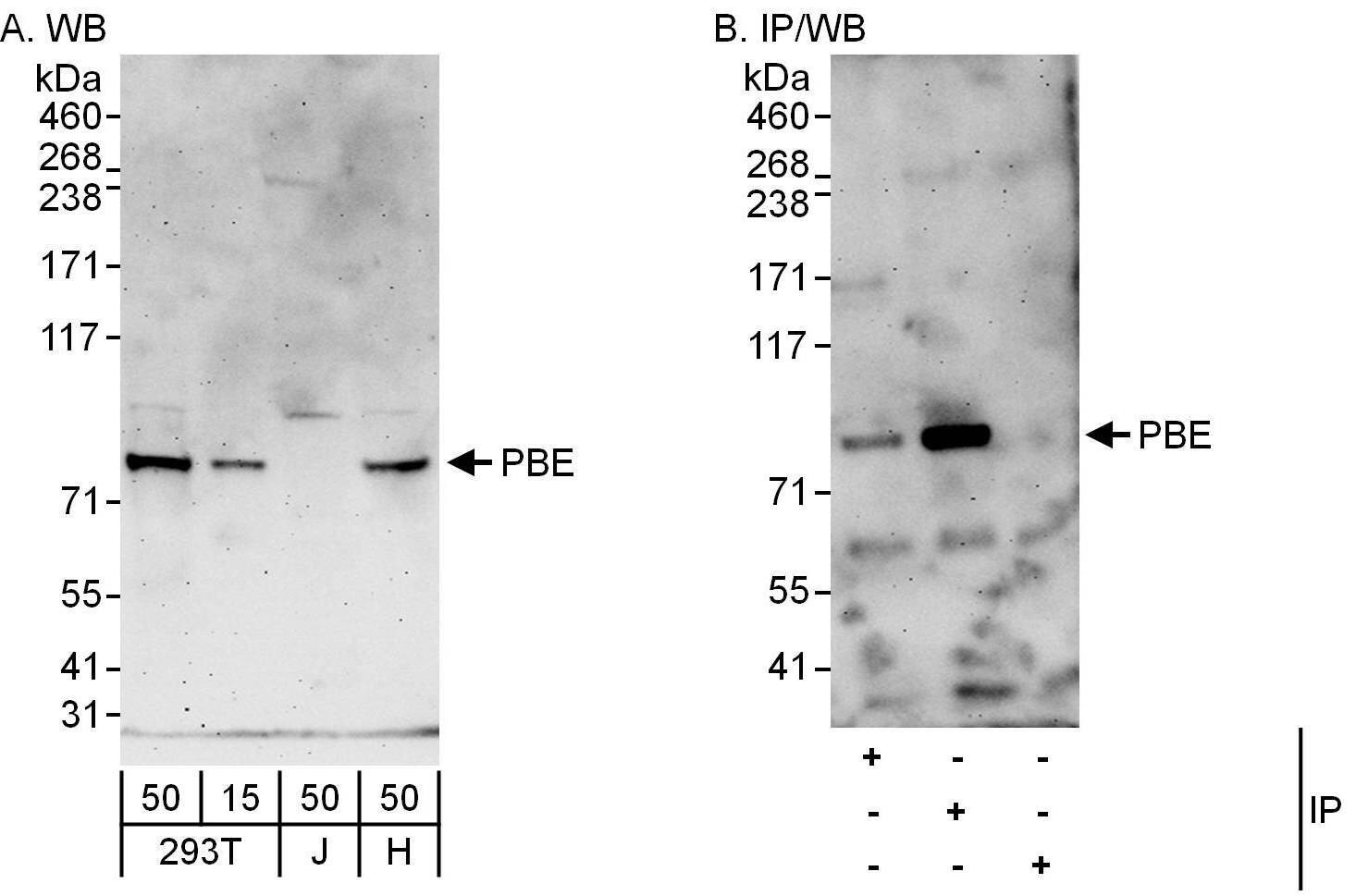EHHADH Antibody