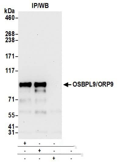 OSBPL9 Antibody