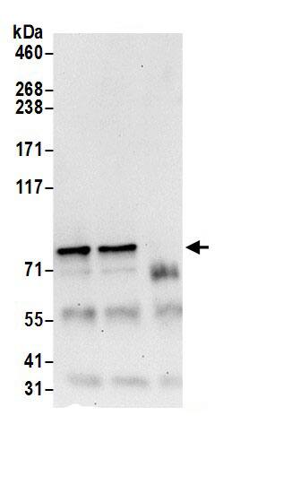 CD2AP Antibody