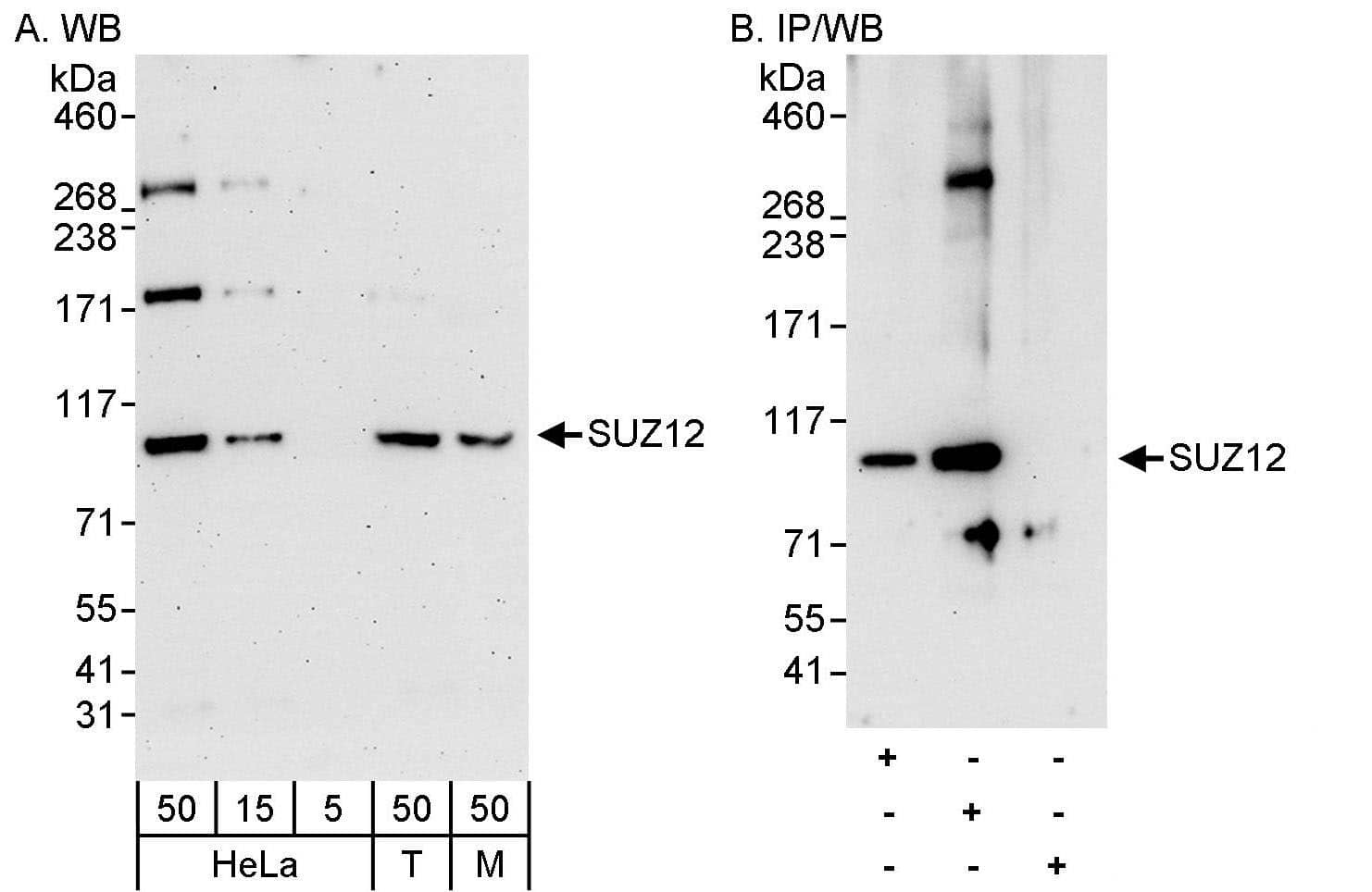 SUZ12 Antibody