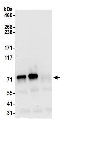 GARS Antibody