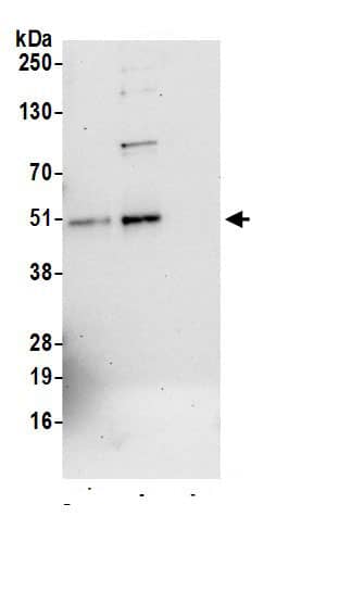 TC-PTP/PTPN2 Antibody