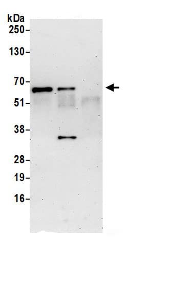 IFIT3 Antibody