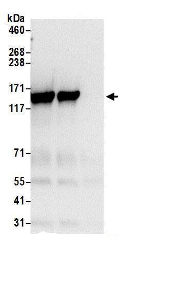 Tripeptidyl peptidase II Antibody