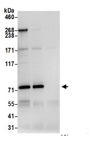 DPP3 Antibody