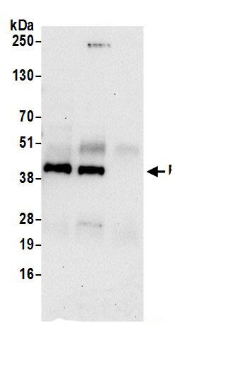 FNTB Antibody