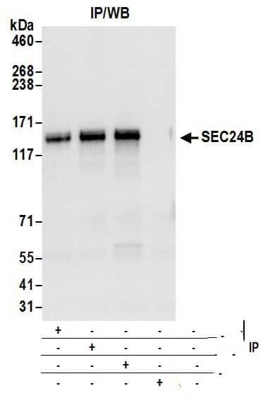 SEC24B Antibody