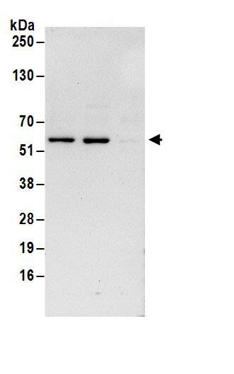 DAPK3/ZIPK Antibody