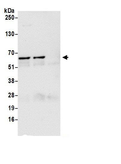 BAIAP2L1 Antibody