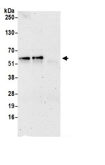 TBCE Antibody