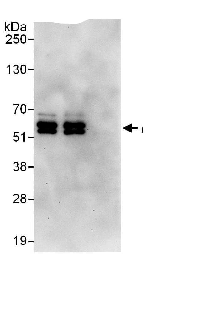 PPP2R5C Antibody