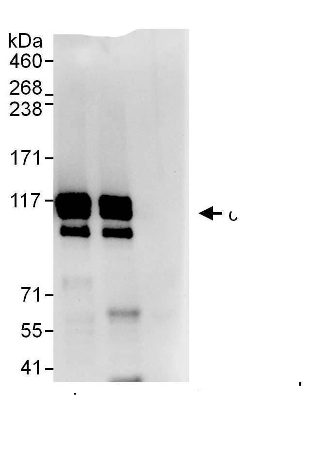 SKI Antibody