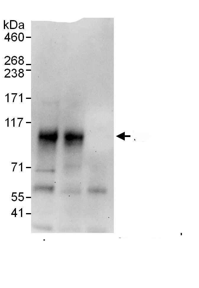 RANK/TNFRSF11A Antibody