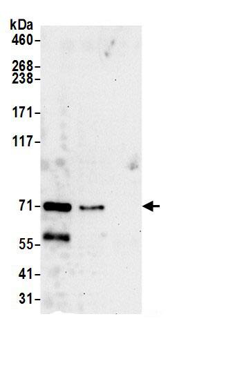 NGLY1 Antibody