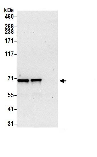 ATP6V1A Antibody