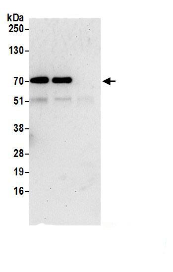 KLHDC5 Antibody