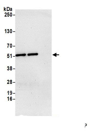 AGPAT7 Antibody