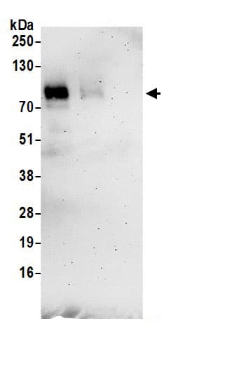 TGF-beta RII Antibody