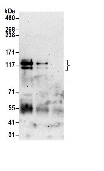 CLCN7 Antibody