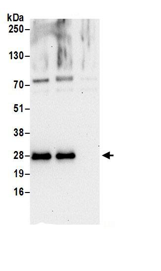 HN1L Antibody