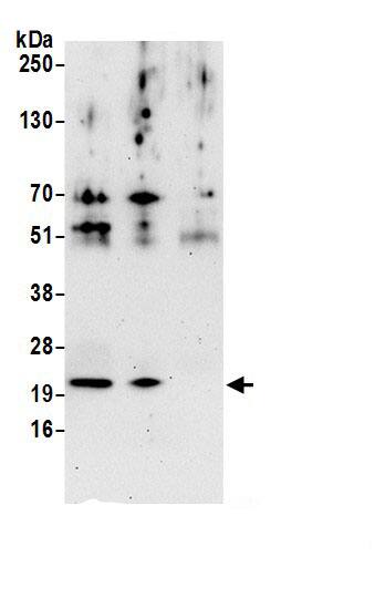 PMVK/phosphomevalonate kinase Antibody