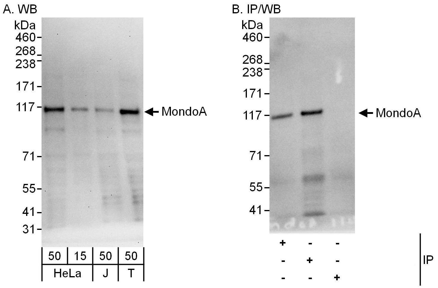 MLXIP Antibody