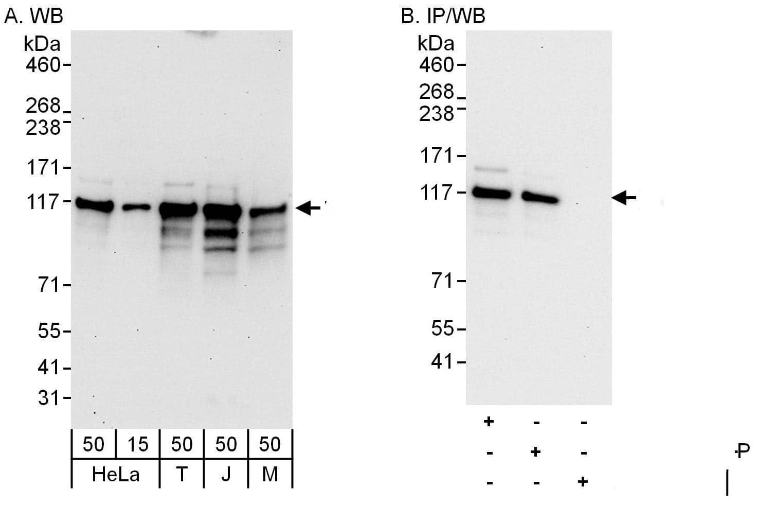 DDX42 Antibody