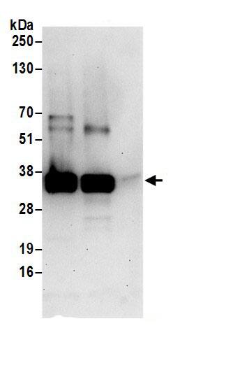 CLNS1A Antibody