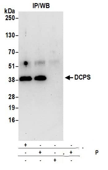 DCPS Antibody